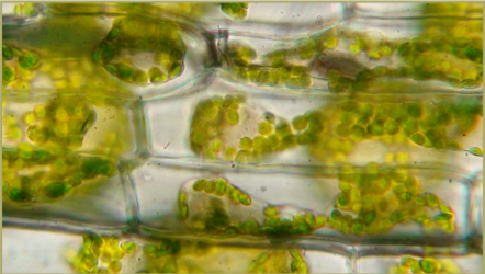 (ENEM 2014 - 3ª Aplicação) Osmose em Célula vegetal (2).png